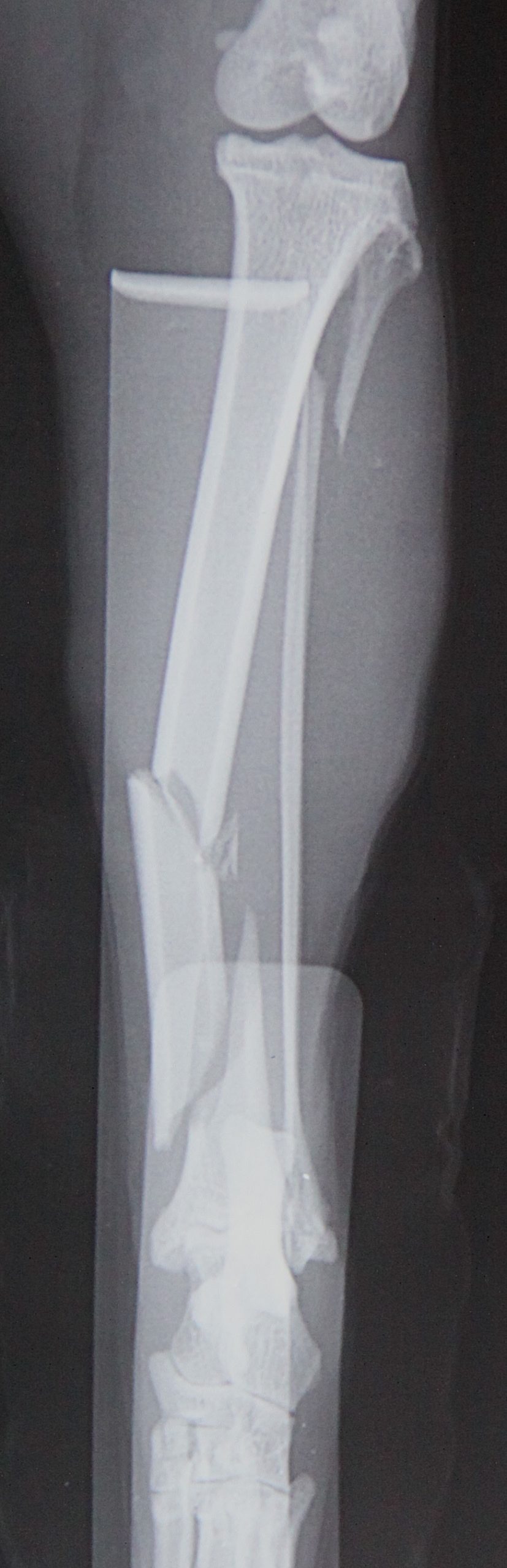 犬・猫の一般的な骨折治療 - 経堂の動物病院｜川瀬獣医科病院・川瀬